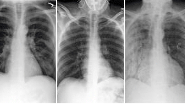 Different x-rays and CT scans displayed 