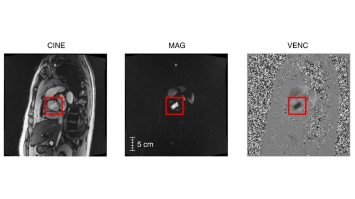 Uncropped MRI frames for CINE, MAG, and VENC series in an oblique coronal view of the thorax