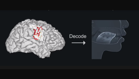 Image showing how brain activity synthesizes speech